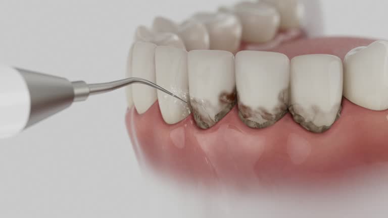 Trusted Dental Implants service in Doolittle, TX - Dentist Open Now